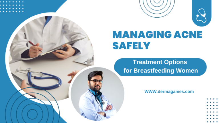 Managing Acne Safely: Treatment Options for Breastfeeding Women  Dermatology Games